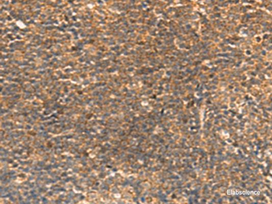 Immunohistochemistry of paraffin-embedded Human tonsil tissue  using STK32C Polyclonal Antibody at dilution of 1:30(×200)