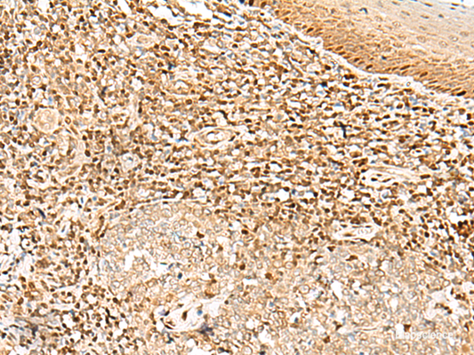 Immunohistochemistry of paraffin-embedded Human tonsil tissue  using DNPEP Polyclonal Antibody at dilution of 1:30(×200)