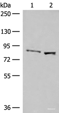 Western blot analysis of Human hepatocellular carcinoma tissue and HepG2 cell lysates  using SLC26A3 Polyclonal Antibody at dilution of 1:250