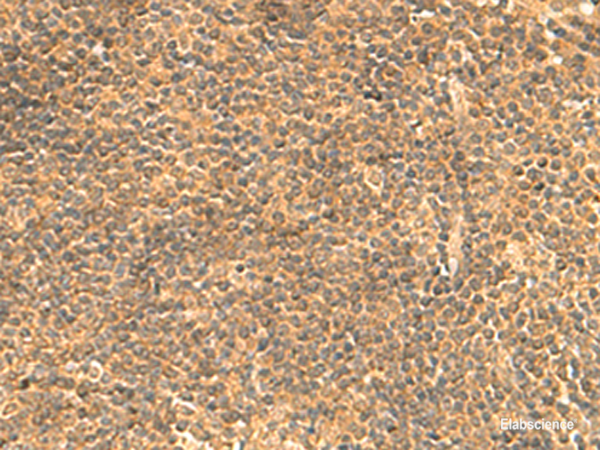 Immunohistochemistry of paraffin-embedded Human tonsil tissue  using FAM186B Polyclonal Antibody at dilution of 1:25(×200)