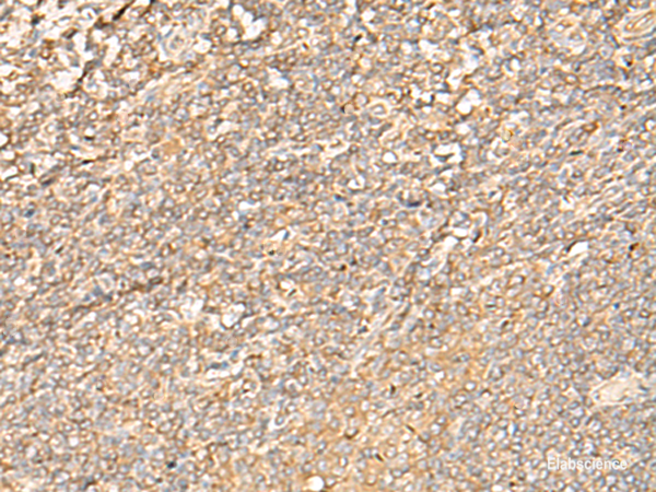 Immunohistochemistry of paraffin-embedded Human tonsil tissue  using EIF3C Polyclonal Antibody at dilution of 1:35(×200)