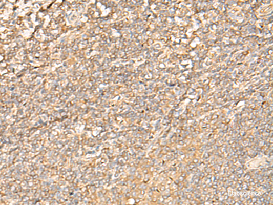 Immunohistochemistry of paraffin-embedded Human tonsil tissue  using EIF3C Polyclonal Antibody at dilution of 1:35(×200)