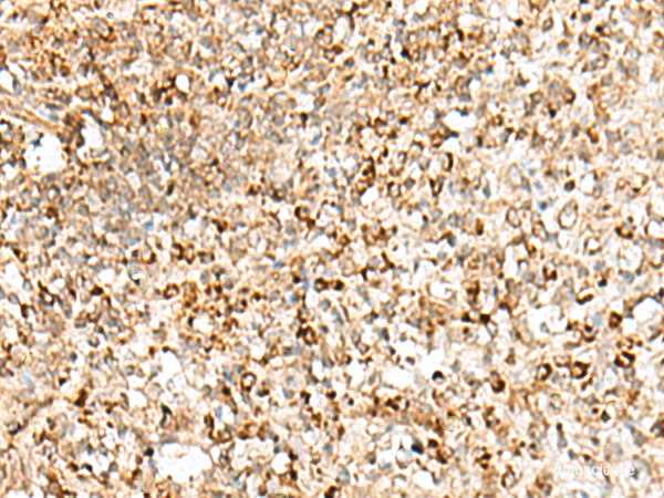Immunohistochemistry of paraffin-embedded Human tonsil tissue  using TEX11 Polyclonal Antibody at dilution of 1:50(×200)