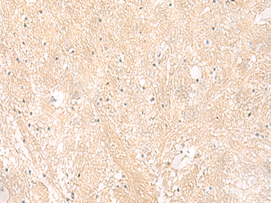 Immunohistochemistry of paraffin-embedded Human brain tissue  using EMC1 Polyclonal Antibody at dilution of 1:35(×200)