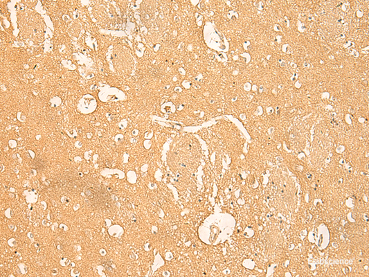 Immunohistochemistry of paraffin-embedded Human brain tissue  using RNASE4 Polyclonal Antibody at dilution of 1:45(×200)