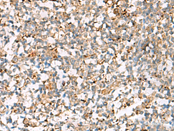 Immunohistochemistry of paraffin-embedded Human tonsil tissue  using NPC2 Polyclonal Antibody at dilution of 1:50(×200)