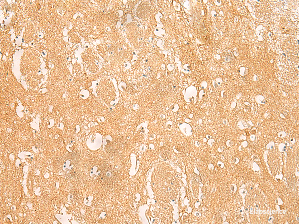 Immunohistochemistry of paraffin-embedded Human brain tissue  using ARPC5L Polyclonal Antibody at dilution of 1:45(×200)