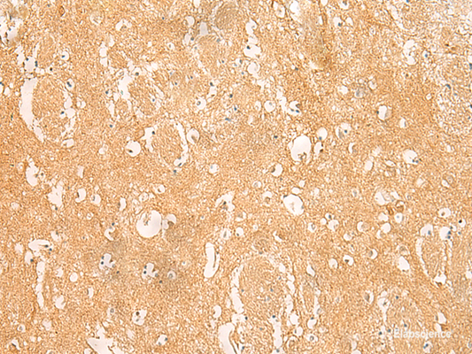 Immunohistochemistry of paraffin-embedded Human brain tissue  using ARPC5L Polyclonal Antibody at dilution of 1:45(×200)