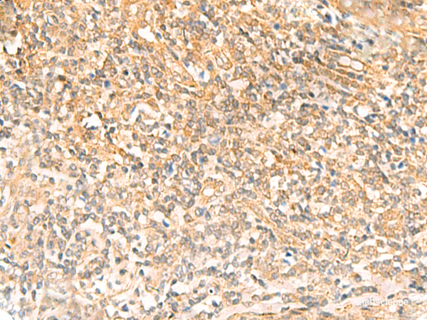 Immunohistochemistry of paraffin-embedded Human tonsil tissue  using UBD Polyclonal Antibody at dilution of 1:50(×200)