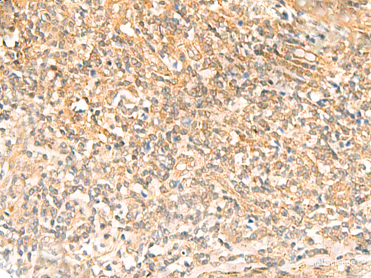 Immunohistochemistry of paraffin-embedded Human tonsil tissue  using UBD Polyclonal Antibody at dilution of 1:50(×200)