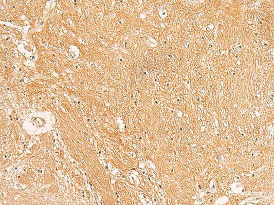 Immunohistochemistry of paraffin-embedded Human brain tissue  using TXNDC12 Polyclonal Antibody at dilution of 1:50(×200)