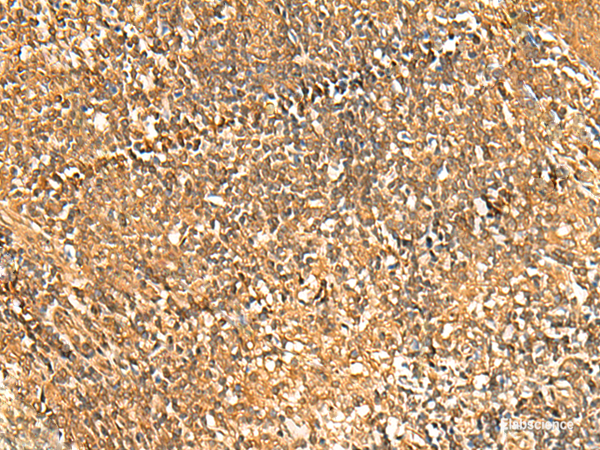 Immunohistochemistry of paraffin-embedded Human tonsil tissue  using GSG1L Polyclonal Antibody at dilution of 1:50(×200)