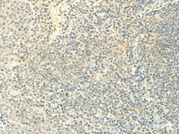 Immunohistochemistry of paraffin-embedded Human tonsil tissue  using FMNL2 Polyclonal Antibody at dilution of 1:50(×200)