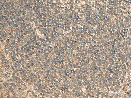 Immunohistochemistry of paraffin-embedded Human tonsil tissue  using GPBP1 Polyclonal Antibody at dilution of 1:65(×200)