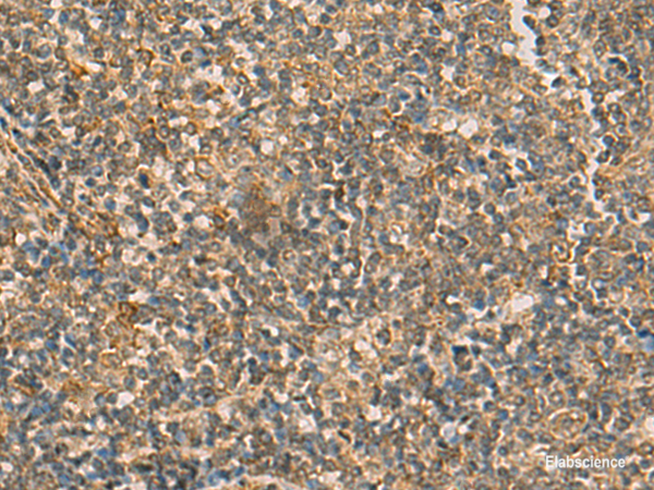 Immunohistochemistry of paraffin-embedded Human tonsil tissue  using IFT22 Polyclonal Antibody at dilution of 1:50(×200)