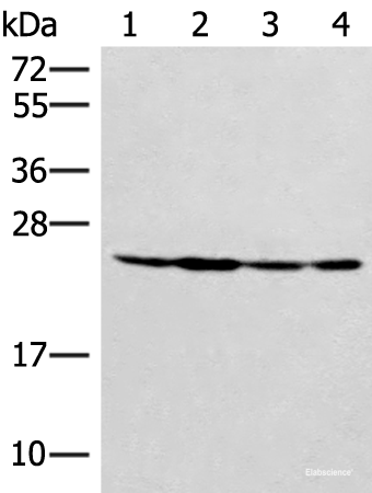 Western blot analysis of Hela 231 and A549 cell Mouse liver tissue lysates  using SSSCA1 Polyclonal Antibody at dilution of 1:400