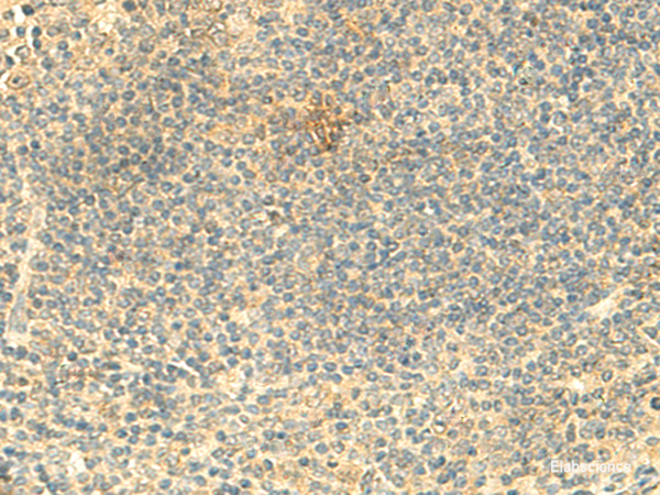 Immunohistochemistry of paraffin-embedded Human tonsil tissue  using ARL4D Polyclonal Antibody at dilution of 1:50(×200)