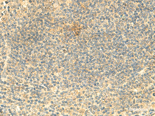 Immunohistochemistry of paraffin-embedded Human tonsil tissue  using ARL4D Polyclonal Antibody at dilution of 1:50(×200)