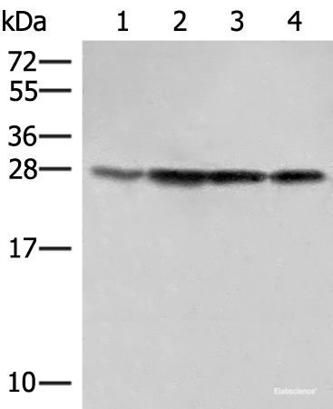 Western blot analysis of 231 Hela LOVO and A172 cell lysates  using SEC22B Polyclonal Antibody at dilution of 1:500