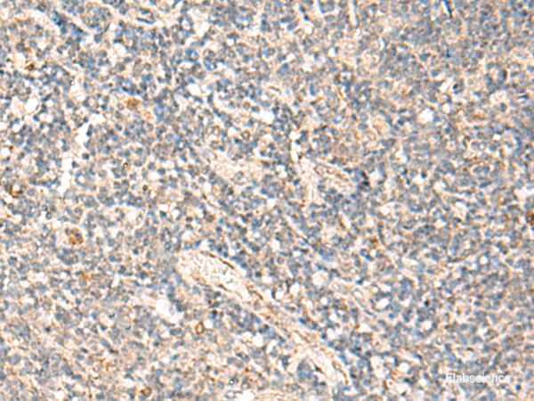 Immunohistochemistry of paraffin-embedded Human tonsil tissue  using MOB1A Polyclonal Antibody at dilution of 1:50(×200)