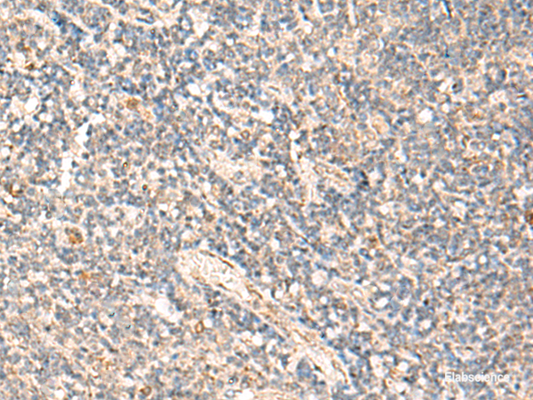 Immunohistochemistry of paraffin-embedded Human tonsil tissue  using MOB1A Polyclonal Antibody at dilution of 1:50(×200)