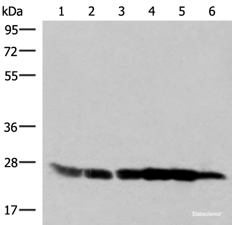 Western blot analysis of 293T HepG2 K562 HT29 A549 and Raji cell lysates  using GSTK1 Polyclonal Antibody at dilution of 1:250