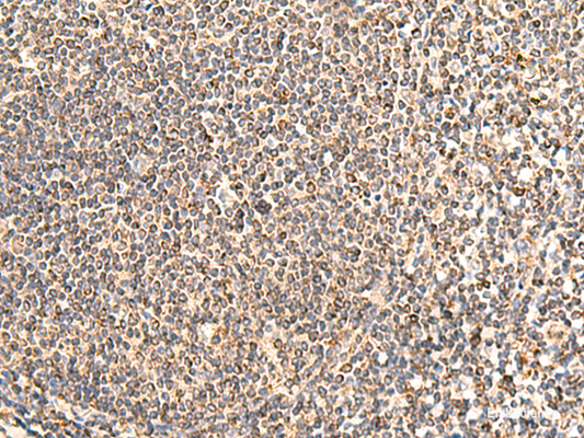 Immunohistochemistry of paraffin-embedded Human tonsil tissue  using NEGR1 Polyclonal Antibody at dilution of 1:50(×200)