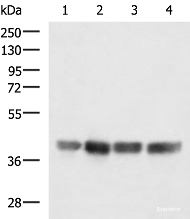 Western blot analysis of LOVO K562 Jurkat and Hela cell lysates  using MRPS35 Polyclonal Antibody at dilution of 1:900