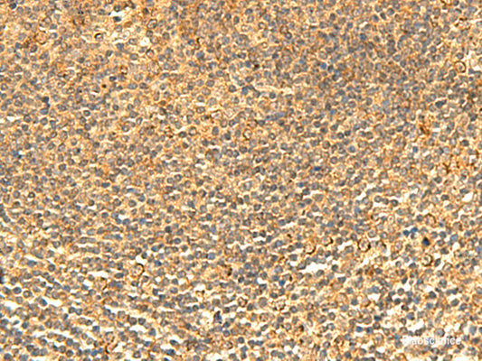 Immunohistochemistry of paraffin-embedded Human tonsil tissue  using ABHD10 Polyclonal Antibody at dilution of 1:50(×200)