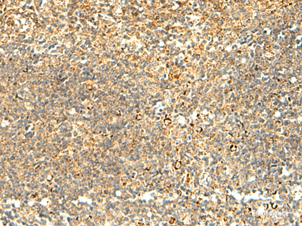 Immunohistochemistry of paraffin-embedded Human tonsil tissue  using NAPRT Polyclonal Antibody at dilution of 1:50(×200)