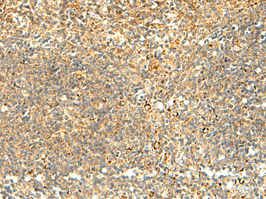 Immunohistochemistry of paraffin-embedded Human tonsil tissue  using NAPRT Polyclonal Antibody at dilution of 1:50(×200)