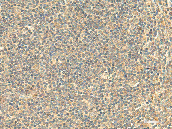 Immunohistochemistry of paraffin-embedded Human tonsil tissue  using NTAN1 Polyclonal Antibody at dilution of 1:50(×200)