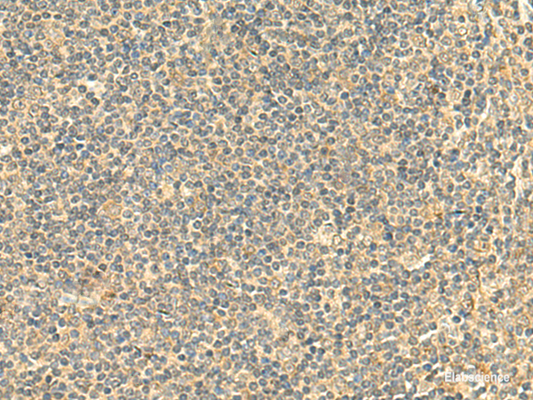 Immunohistochemistry of paraffin-embedded Human tonsil tissue  using NTAN1 Polyclonal Antibody at dilution of 1:50(×200)