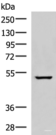 Western blot analysis of A549 cell lysate  using NKD2 Polyclonal Antibody at dilution of 1:600
