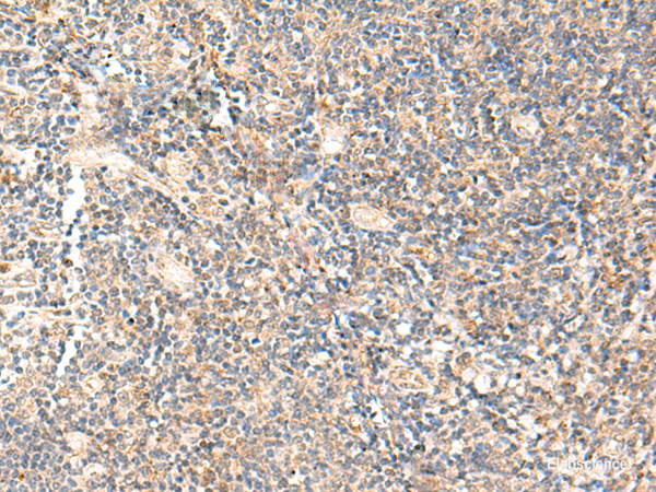 Immunohistochemistry of paraffin-embedded Human tonsil tissue  using PPP1R3C Polyclonal Antibody at dilution of 1:50(×200)