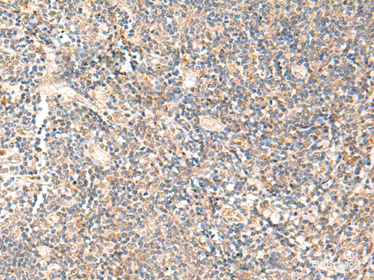 Immunohistochemistry of paraffin-embedded Human tonsil tissue  using PPP1R3C Polyclonal Antibody at dilution of 1:50(×200)