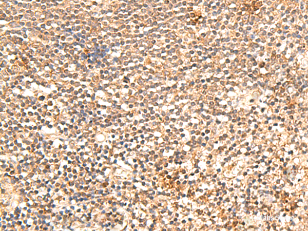 Immunohistochemistry of paraffin-embedded Human tonsil tissue  using TRAPPC1 Polyclonal Antibody at dilution of 1:60(×200)