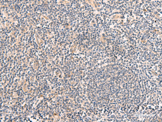 Immunohistochemistry of paraffin-embedded Human tonsil tissue  using TEAD3 Polyclonal Antibody at dilution of 1:50(×200)