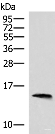 Western blot analysis of Human pancreas tissue lysate  using REG1B Polyclonal Antibody at dilution of 1:800