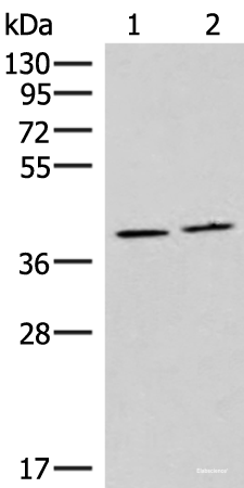 Western blot analysis of Human placenta tissue and Human fetal brain tissue lysates  using HMGCLL1 Polyclonal Antibody at dilution of 1:1000
