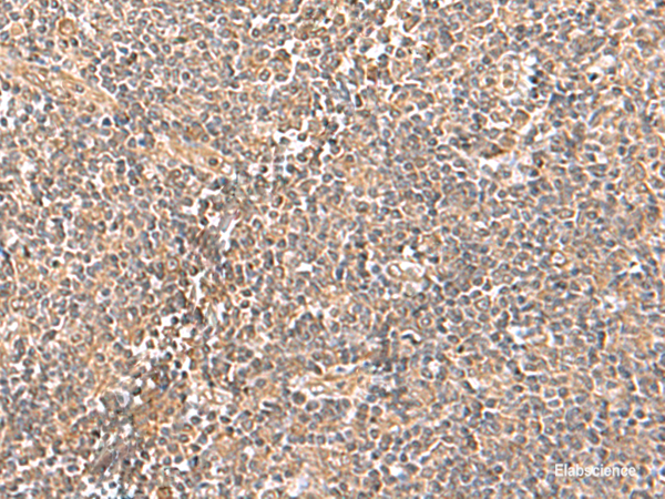 Immunohistochemistry of paraffin-embedded Human tonsil tissue  using TRUB1 Polyclonal Antibody at dilution of 1:70(×200)