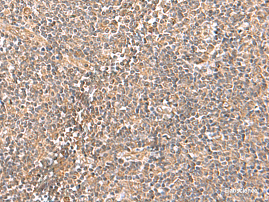 Immunohistochemistry of paraffin-embedded Human tonsil tissue  using TRUB1 Polyclonal Antibody at dilution of 1:70(×200)