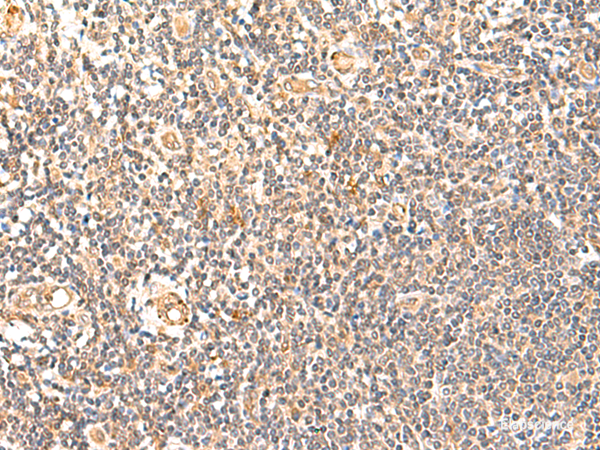 Immunohistochemistry of paraffin-embedded Human tonsil tissue  using GPD1L Polyclonal Antibody at dilution of 1:60(×200)