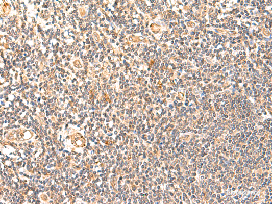 Immunohistochemistry of paraffin-embedded Human tonsil tissue  using GPD1L Polyclonal Antibody at dilution of 1:60(×200)