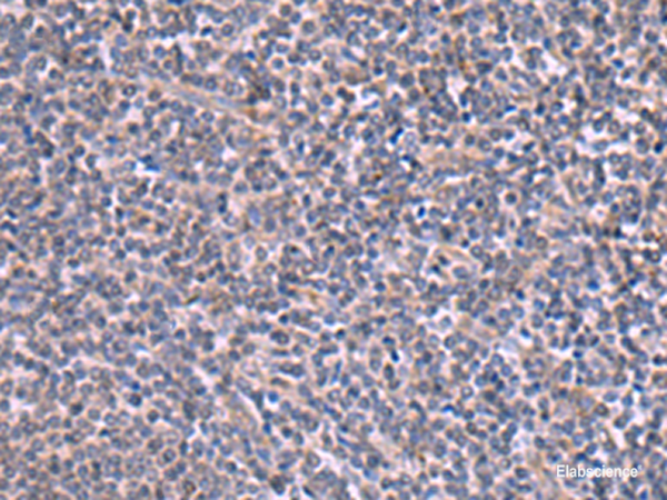 Immunohistochemistry of paraffin-embedded Human tonsil tissue  using RIC3 Polyclonal Antibody at dilution of 1:90(×200)
