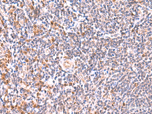 Immunohistochemistry of paraffin-embedded Human tonsil tissue  using GMDS Polyclonal Antibody at dilution of 1:55(×200)