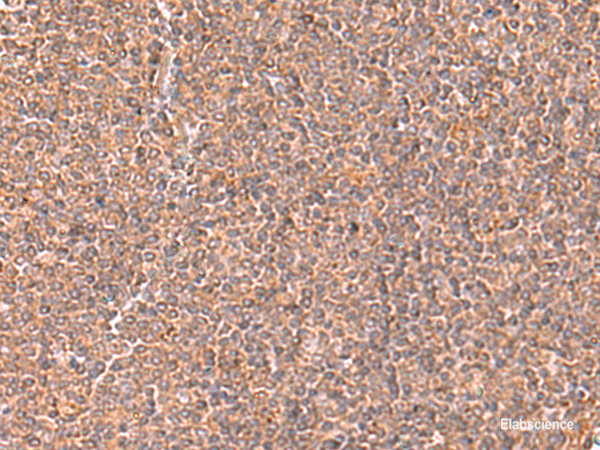 Immunohistochemistry of paraffin-embedded Human tonsil tissue  using RABEPK Polyclonal Antibody at dilution of 1:65(×200)