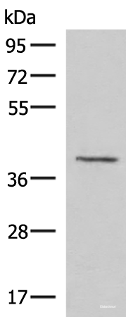 Western blot analysis of Human fetal brain tissue lysate  using MECR Polyclonal Antibody at dilution of 1:1000