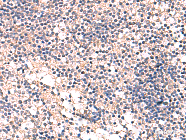 Immunohistochemistry of paraffin-embedded Human tonsil tissue  using MKS1 Polyclonal Antibody at dilution of 1:50(×200)