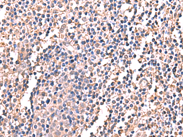 Immunohistochemistry of paraffin-embedded Human tonsil tissue  using LDHAL6B Polyclonal Antibody at dilution of 1:60(×200)